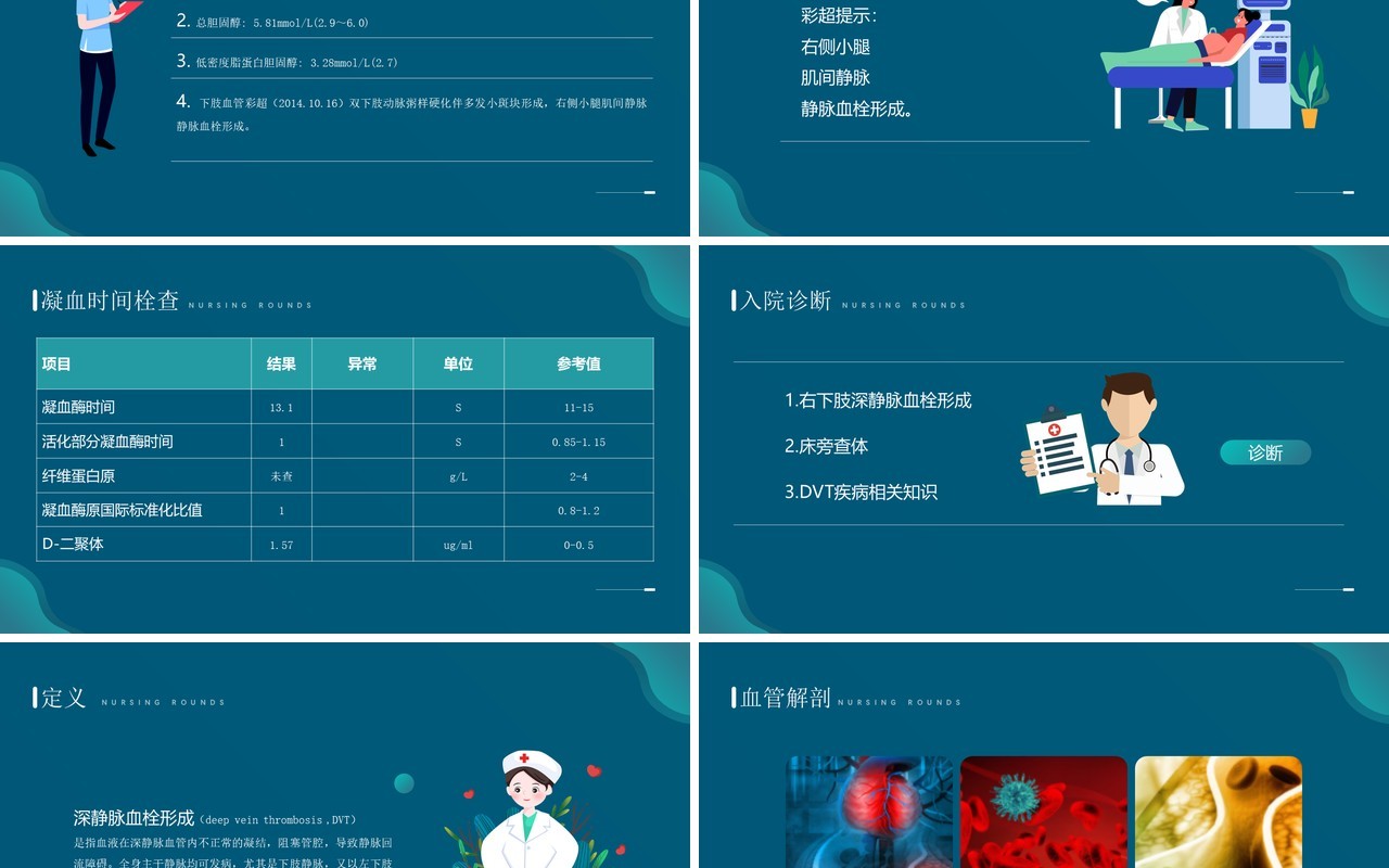绿色卡通风下肢静脉血栓护理查房PPT模板