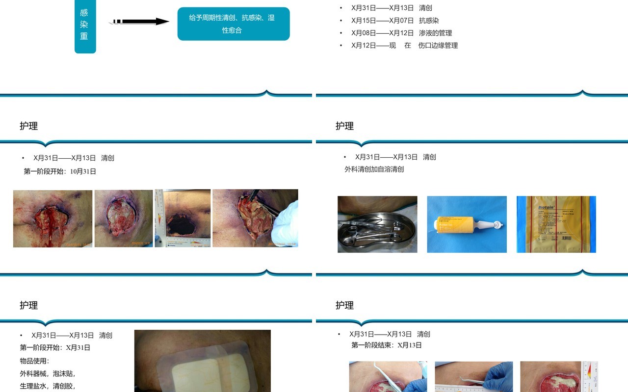 胶质瘤术后病人压疮护理PPT模板