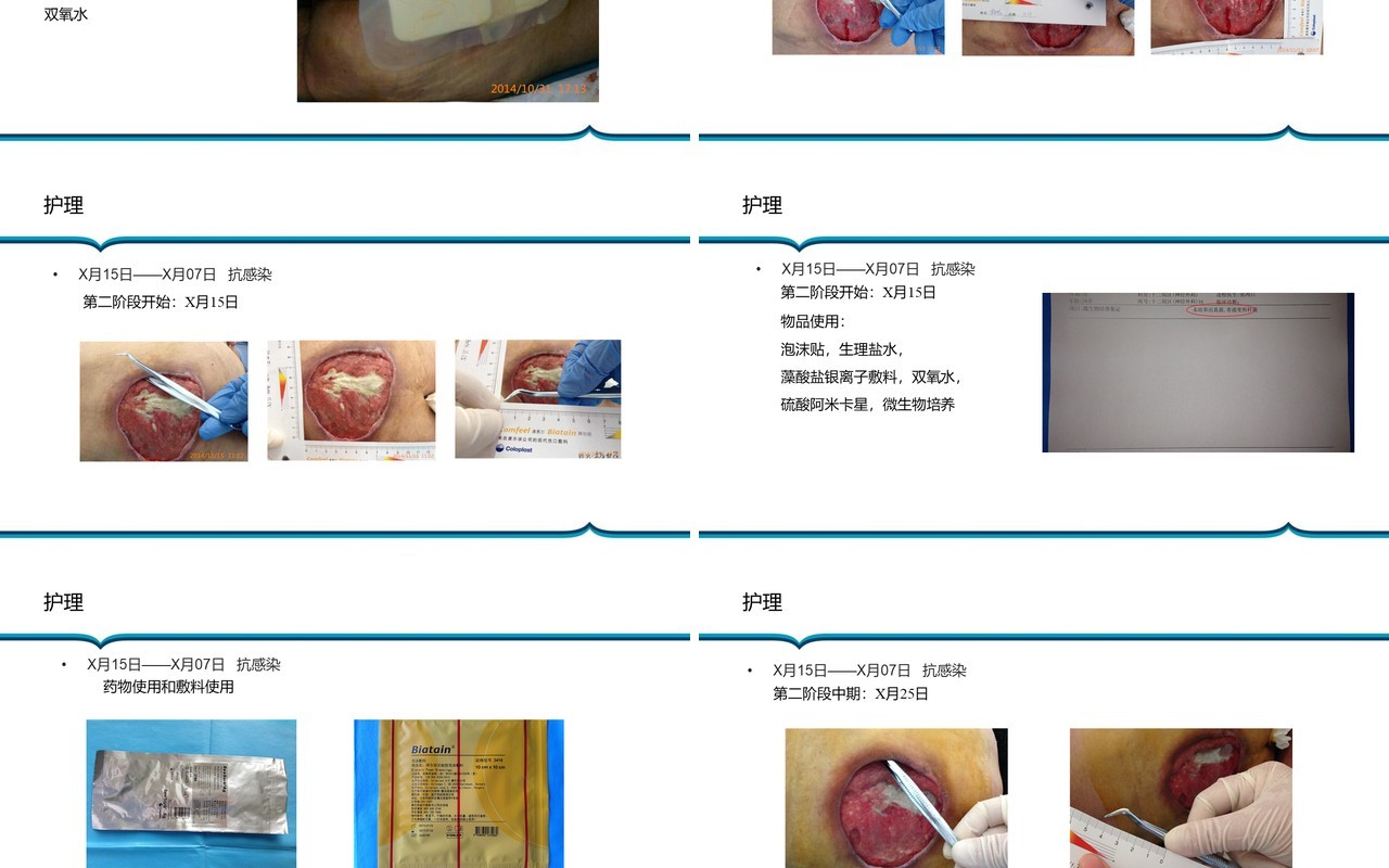胶质瘤术后病人压疮护理PPT模板