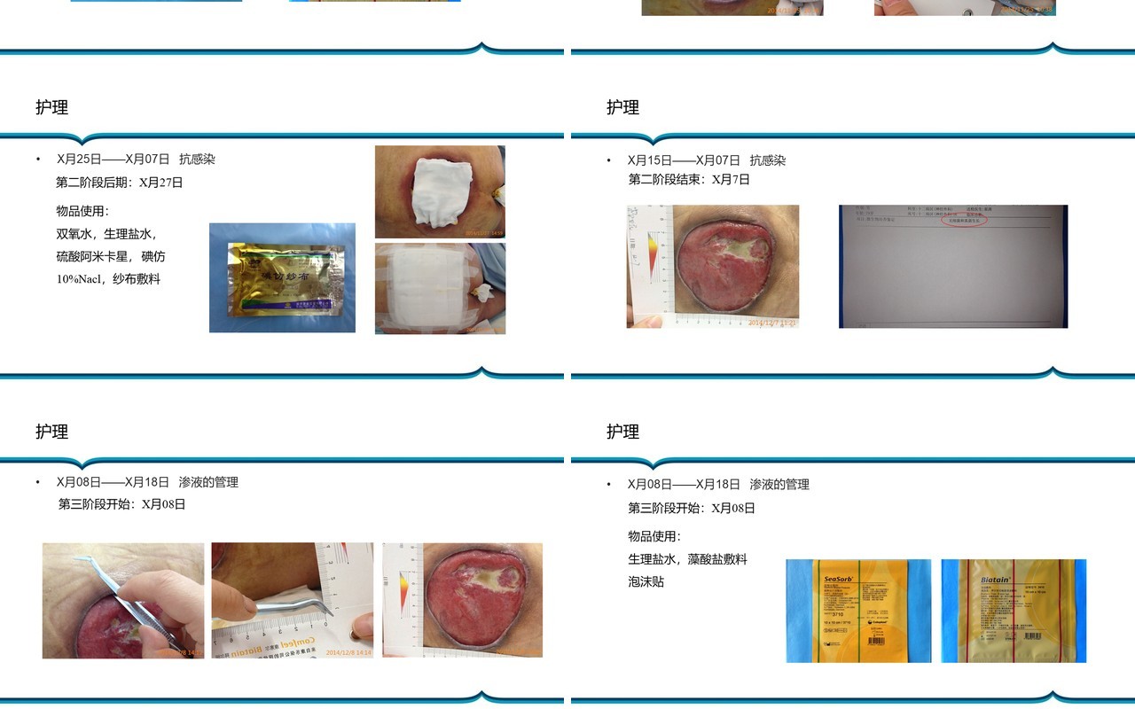 胶质瘤术后病人压疮护理PPT模板