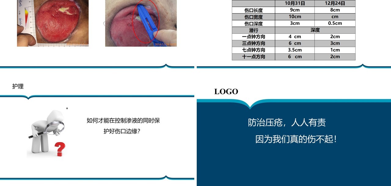 胶质瘤术后病人压疮护理PPT模板