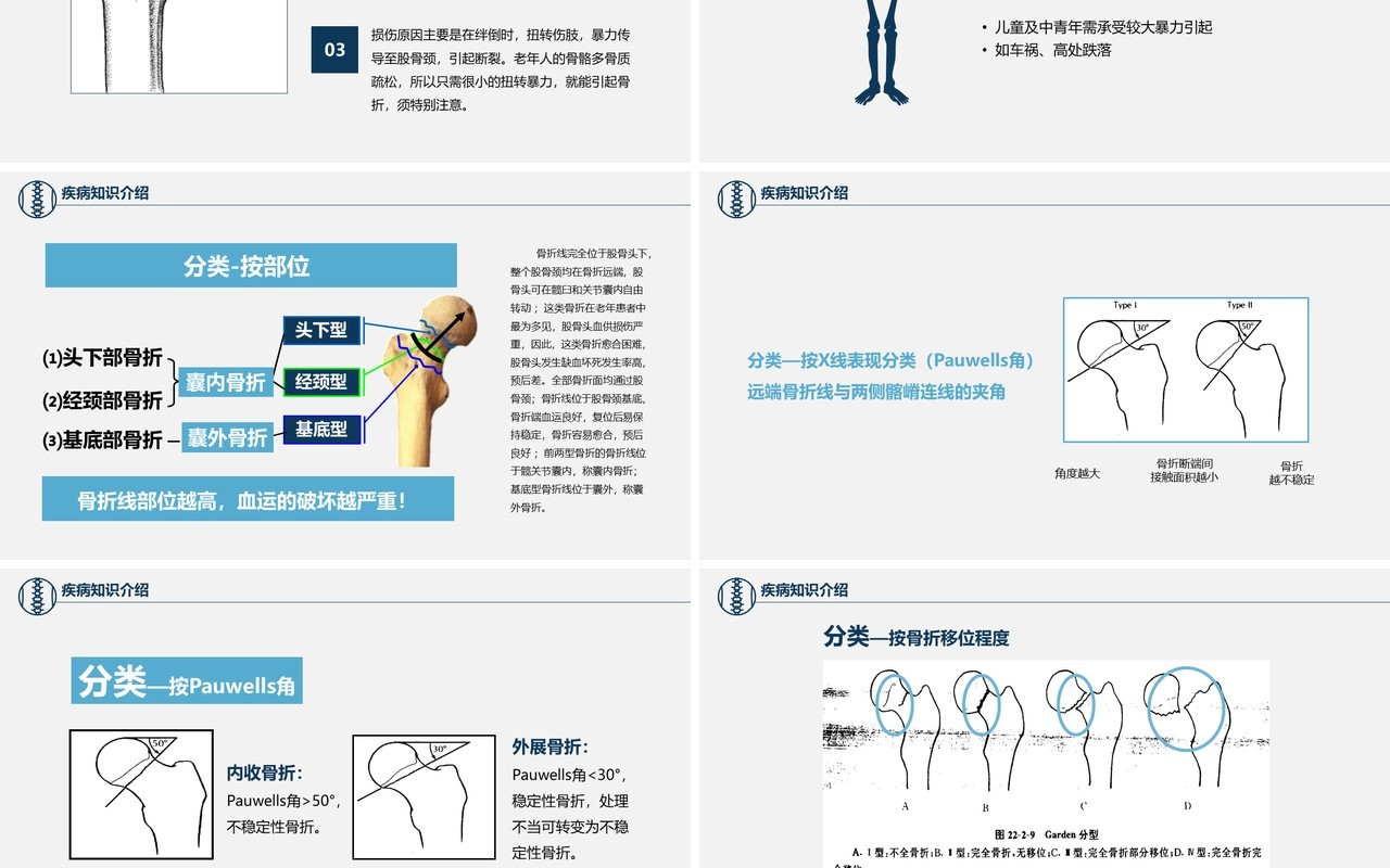 卡通简约风医学股骨颈骨折护理查房PPT模板