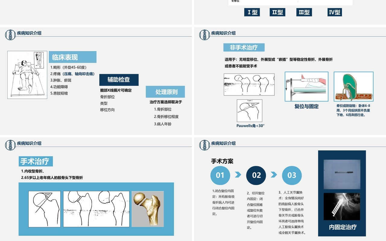 卡通简约风医学股骨颈骨折护理查房PPT模板