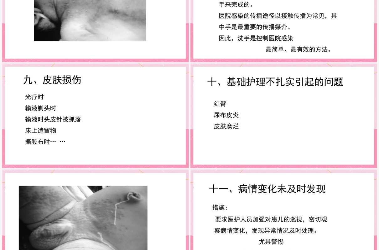 粉色新生儿病房的护理安全管理PPT模板
