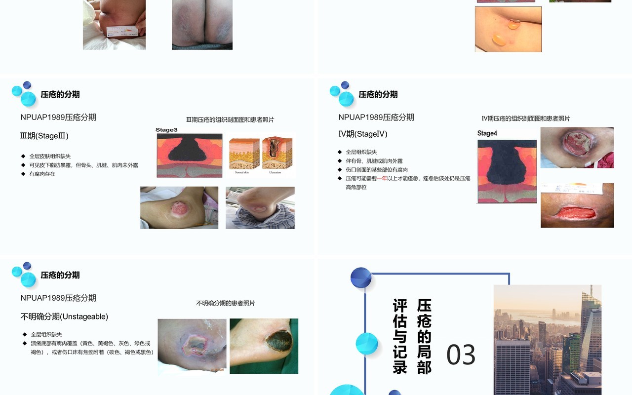 医用压疮护理新进展PPT模板