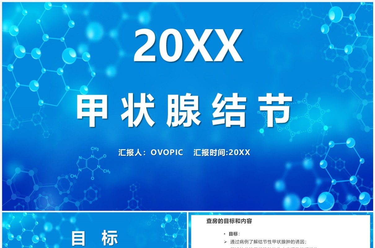 蓝色甲状腺结节介绍PPT模板