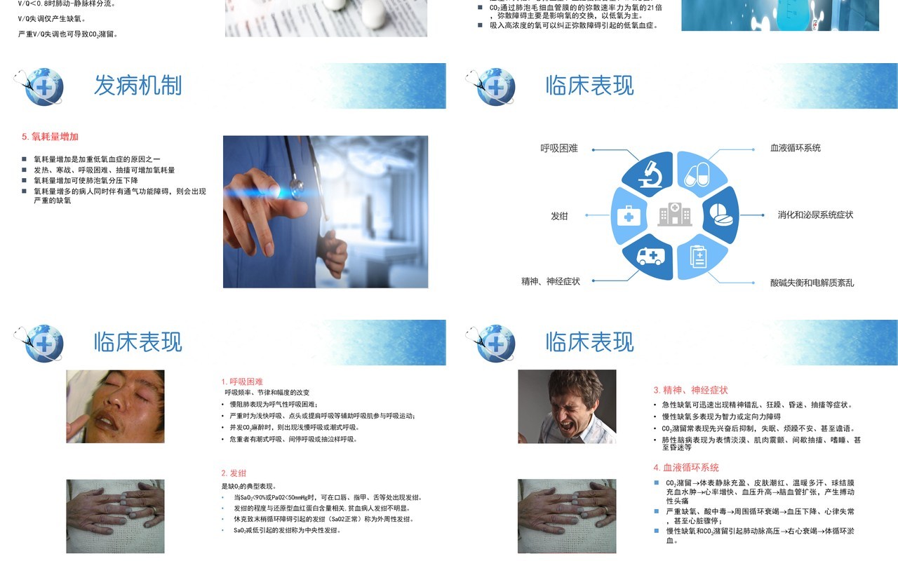 简约医院呼吸衰竭护理查房PPT模板