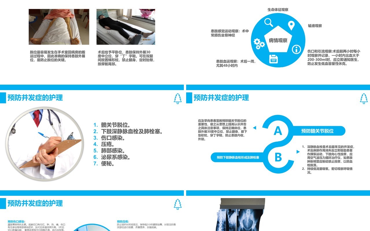 蓝色课件股骨颈骨折护理查房PPT模板