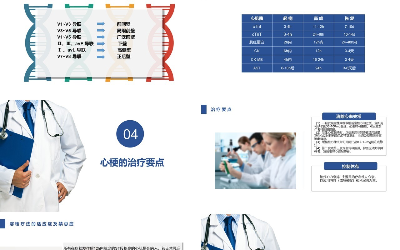 简约急性心肌梗死护理查房PPT模板