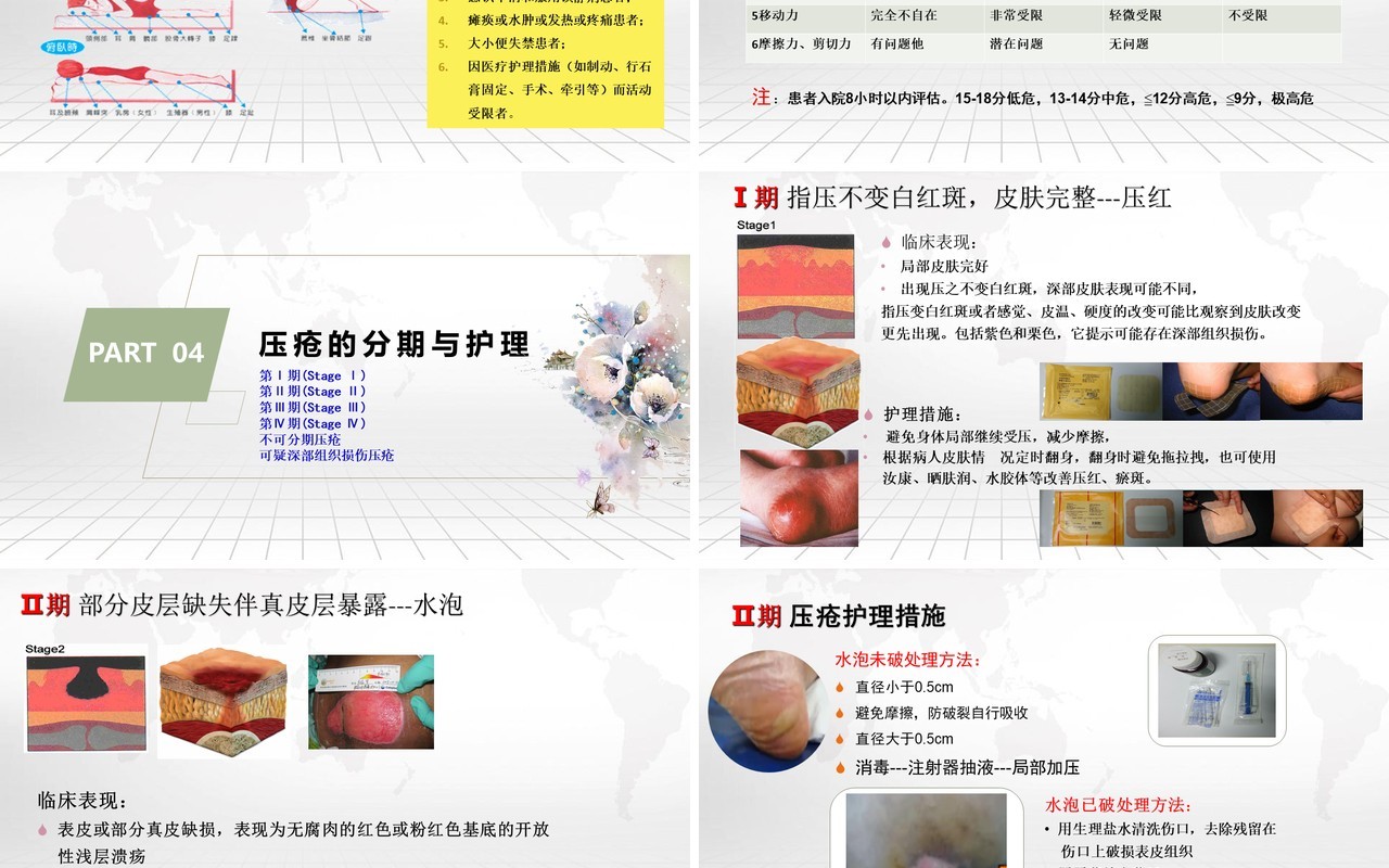 压疮的预防及护理医院用PPT模板