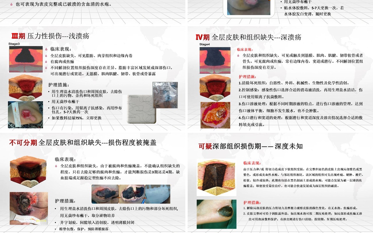 压疮的预防及护理医院用PPT模板