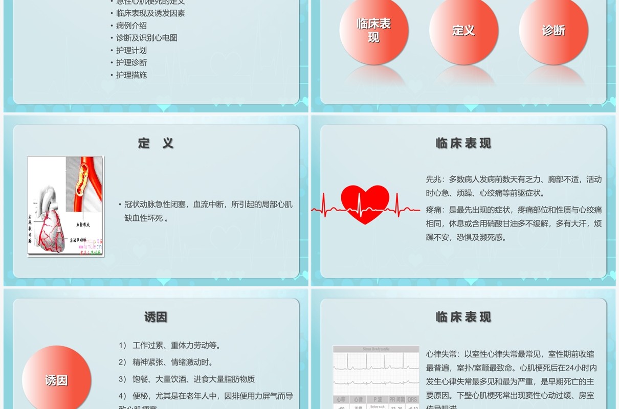 卡通手绘风急性心肌梗死护理查房PPT模板