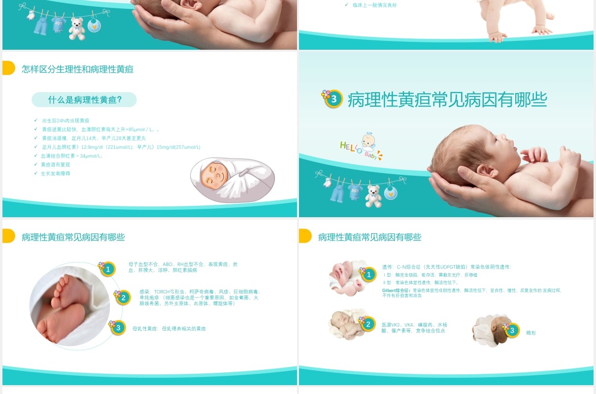 蓝色新生儿黄疸母婴护理培训PPT模板