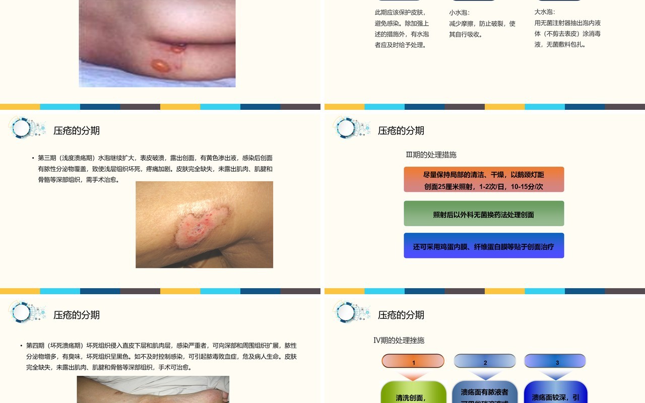 医疗医院用压疮护理PPT模板