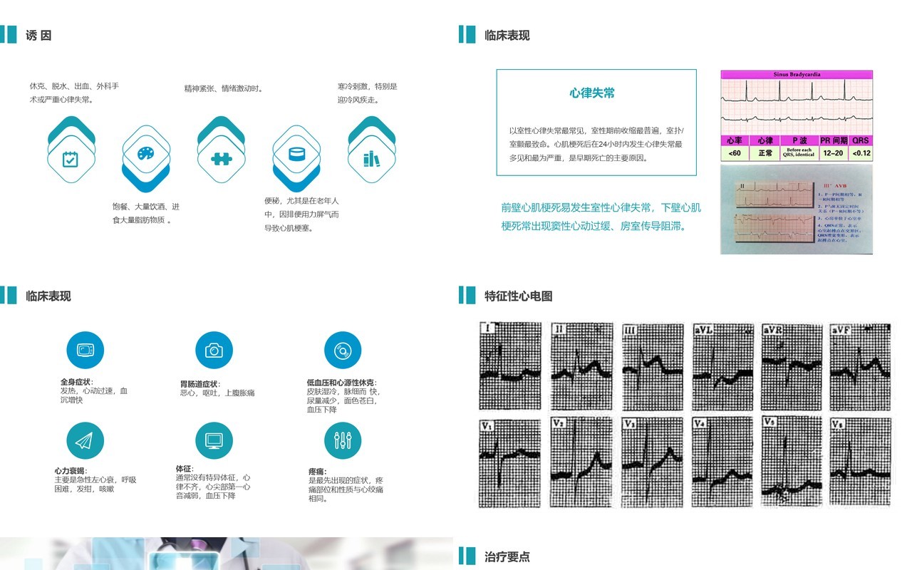 蓝色医院医疗急性心梗护理查房PPT心肌梗塞病例讨论模板