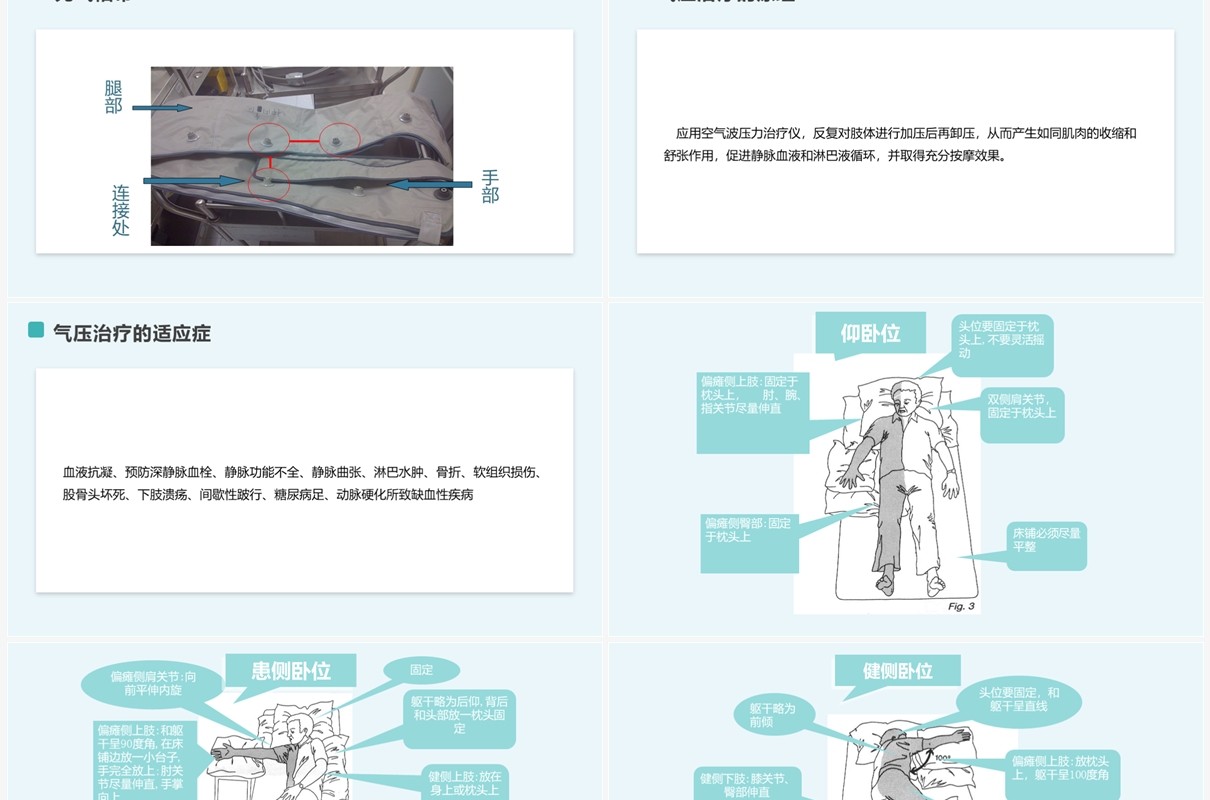 绿色简约脑梗塞护理查房PPT模板