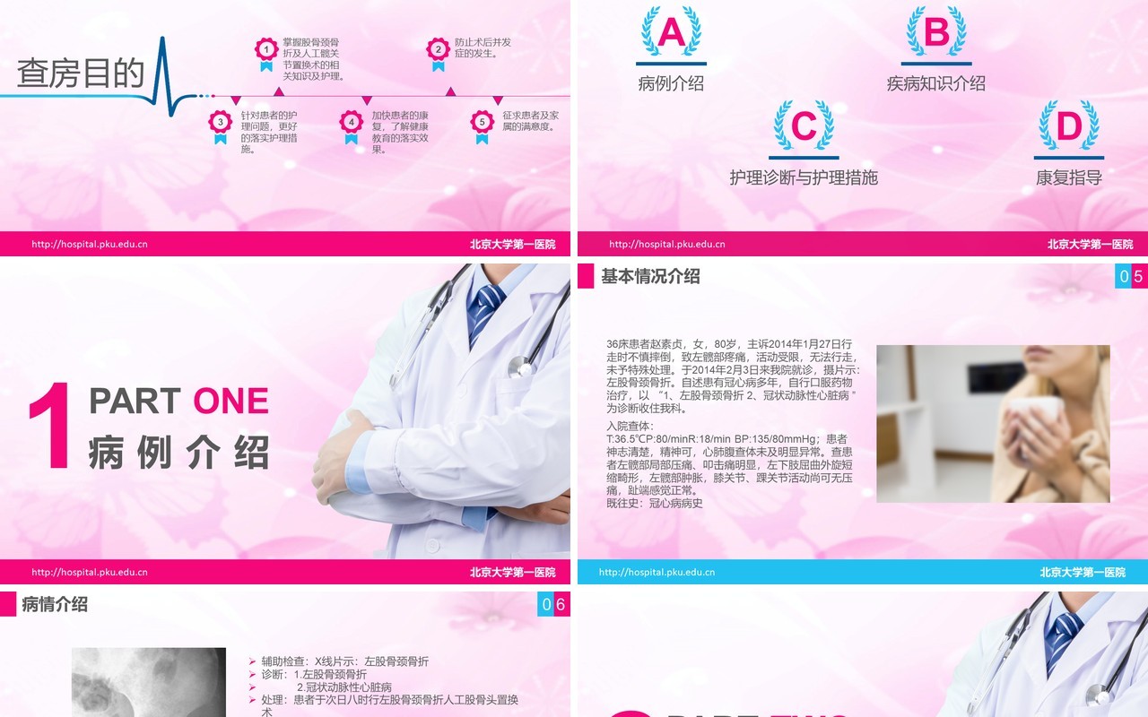 简洁医院医疗股骨颈骨折护理查房PPT模板
