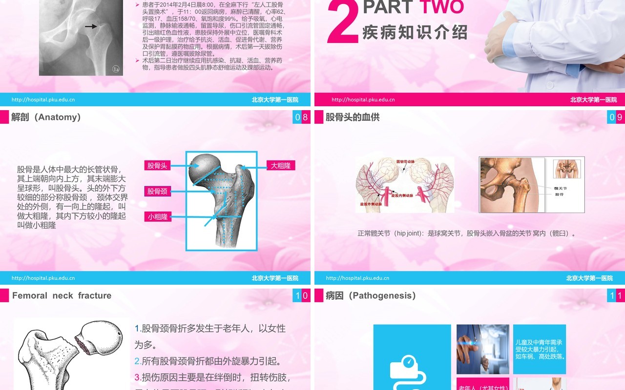 简洁医院医疗股骨颈骨折护理查房PPT模板