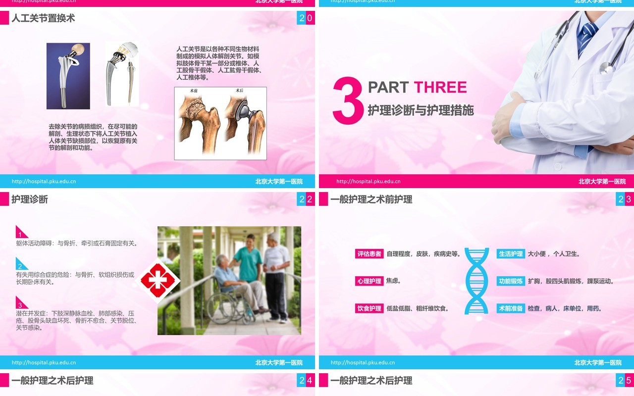 简洁医院医疗股骨颈骨折护理查房PPT模板
