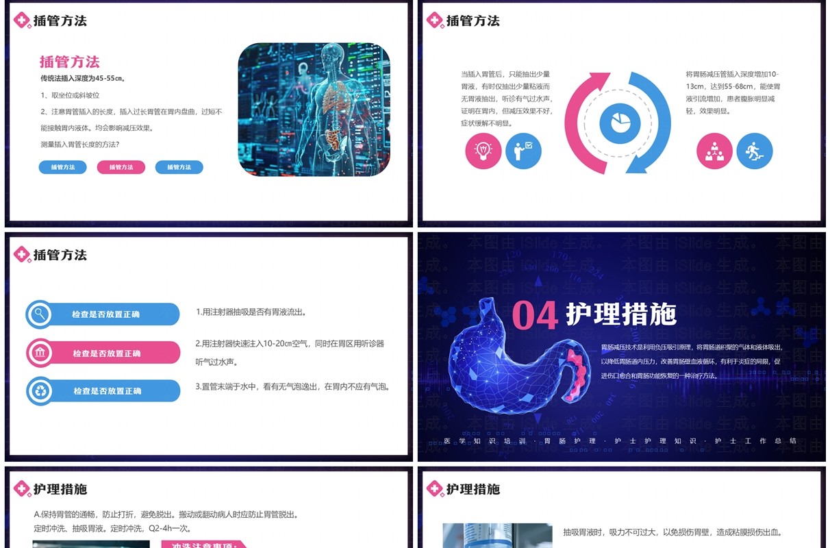 蓝色简约风胃肠减压的护理PPT模板