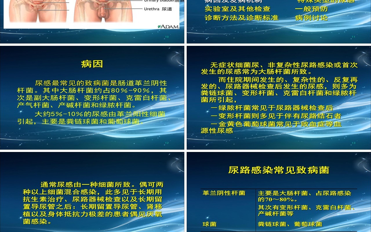 简约泌尿系尿路感染护理查房PPT模板