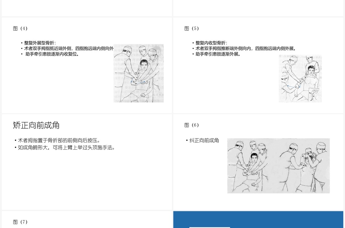 蓝色肱骨外科颈骨折PPT模板