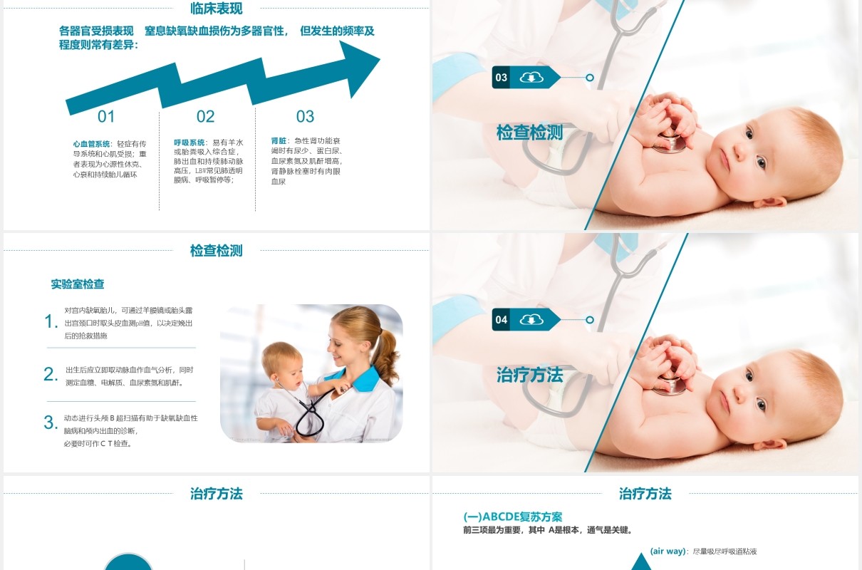 简约新生儿窒息复苏护理培训医疗PPT模板