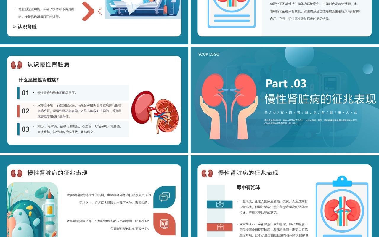 蓝色简约医疗慢性肾脏病宣传教育PPT模板