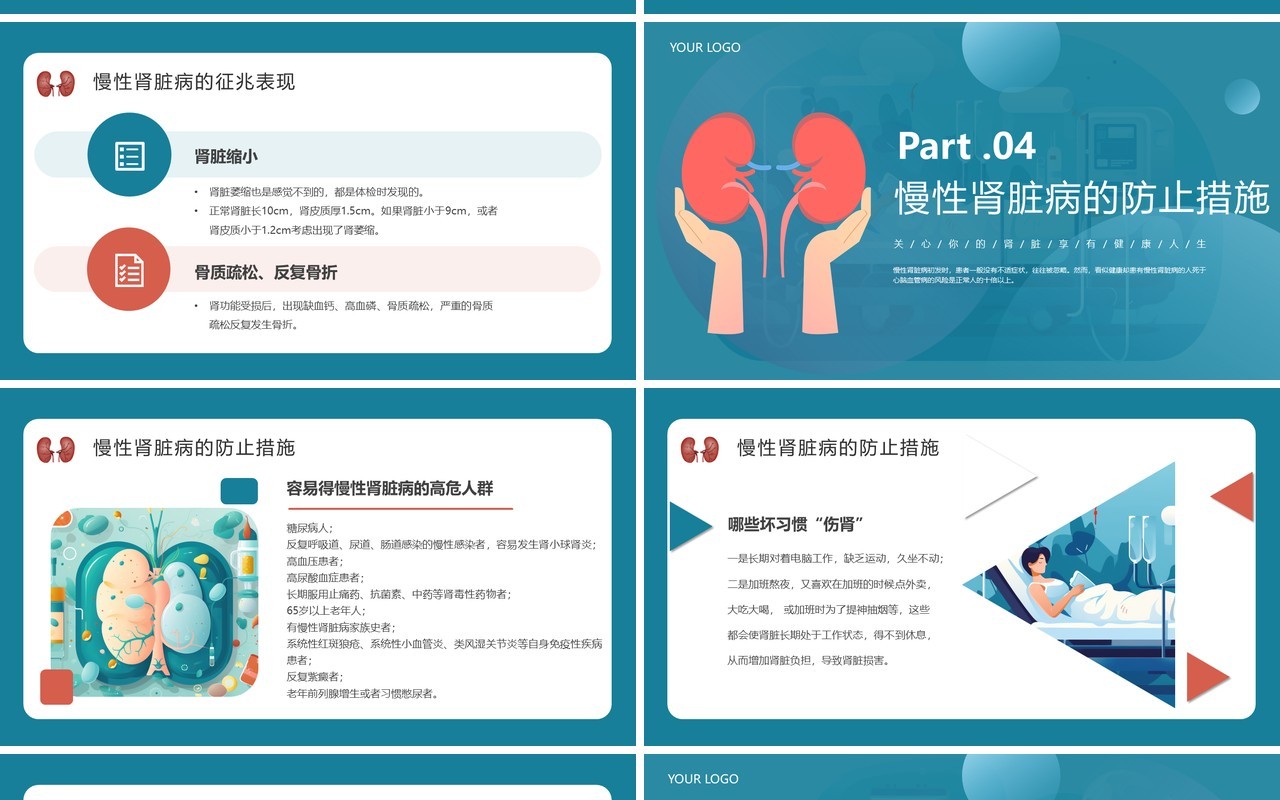 蓝色简约医疗慢性肾脏病宣传教育PPT模板