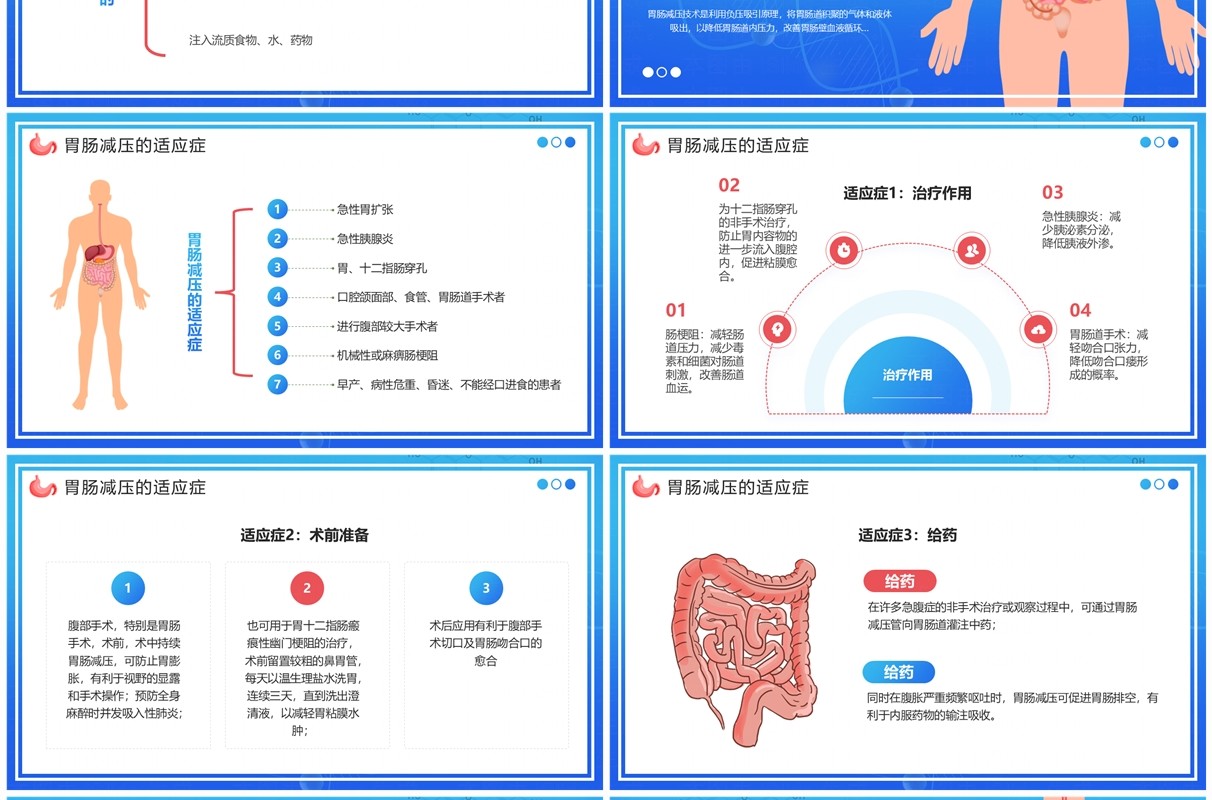 蓝色卡通风胃肠减压的护理PPT模板