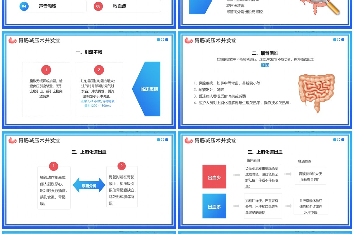 蓝色卡通风胃肠减压的护理PPT模板
