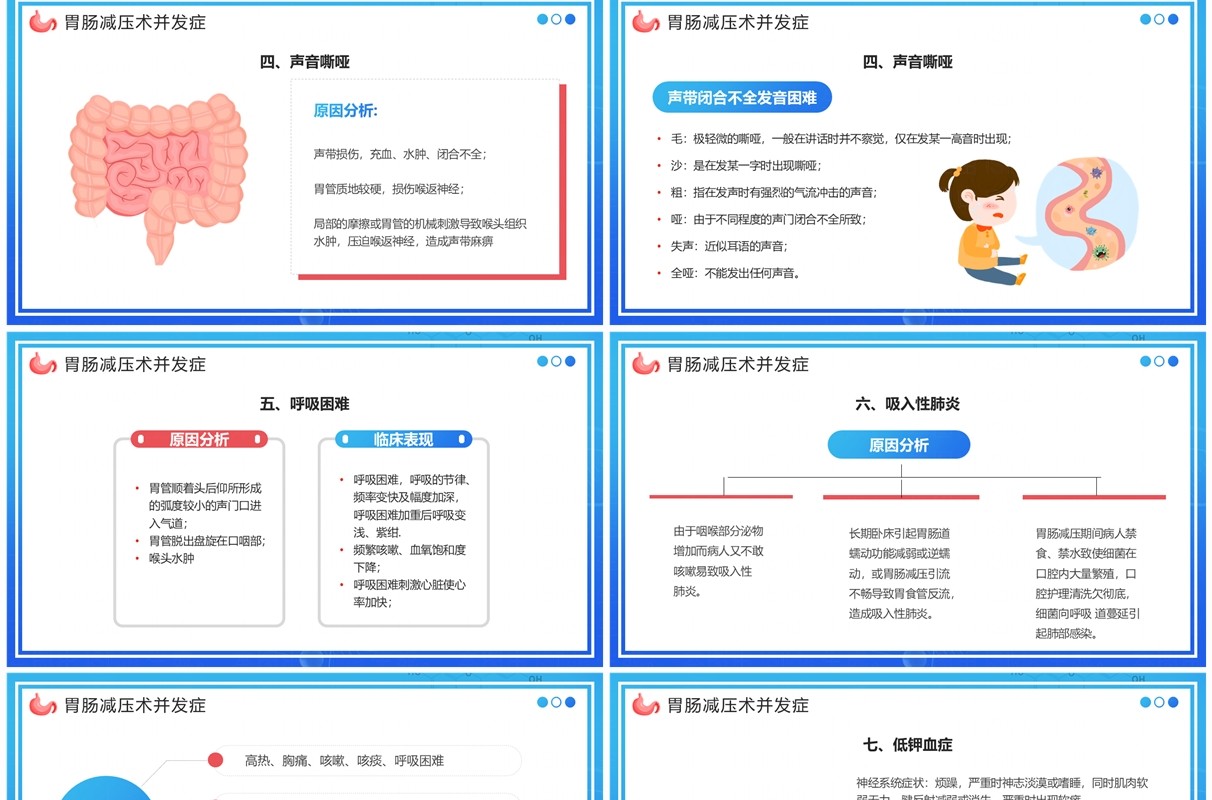 蓝色卡通风胃肠减压的护理PPT模板