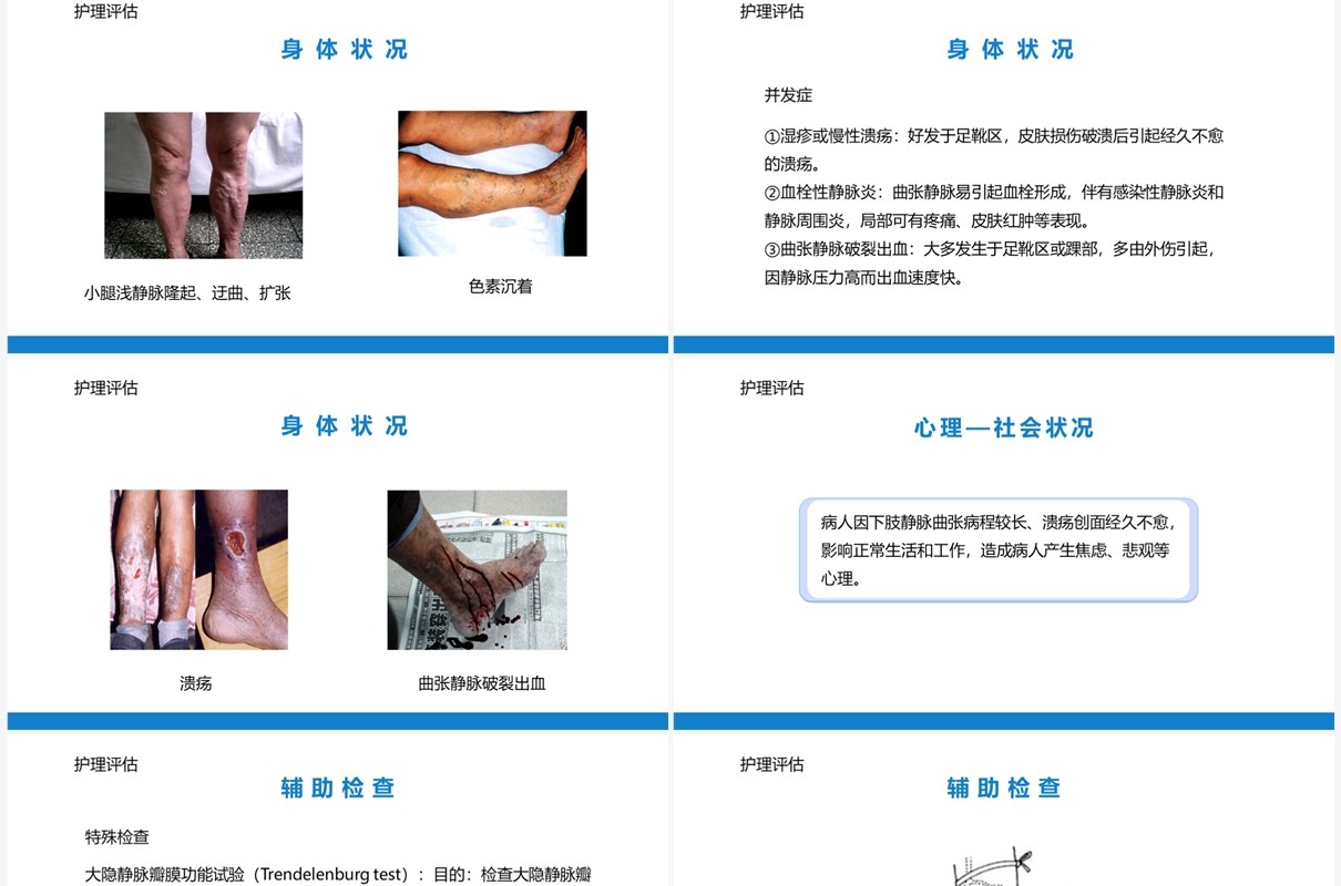 周围血管疾病病人的护理PPT模板